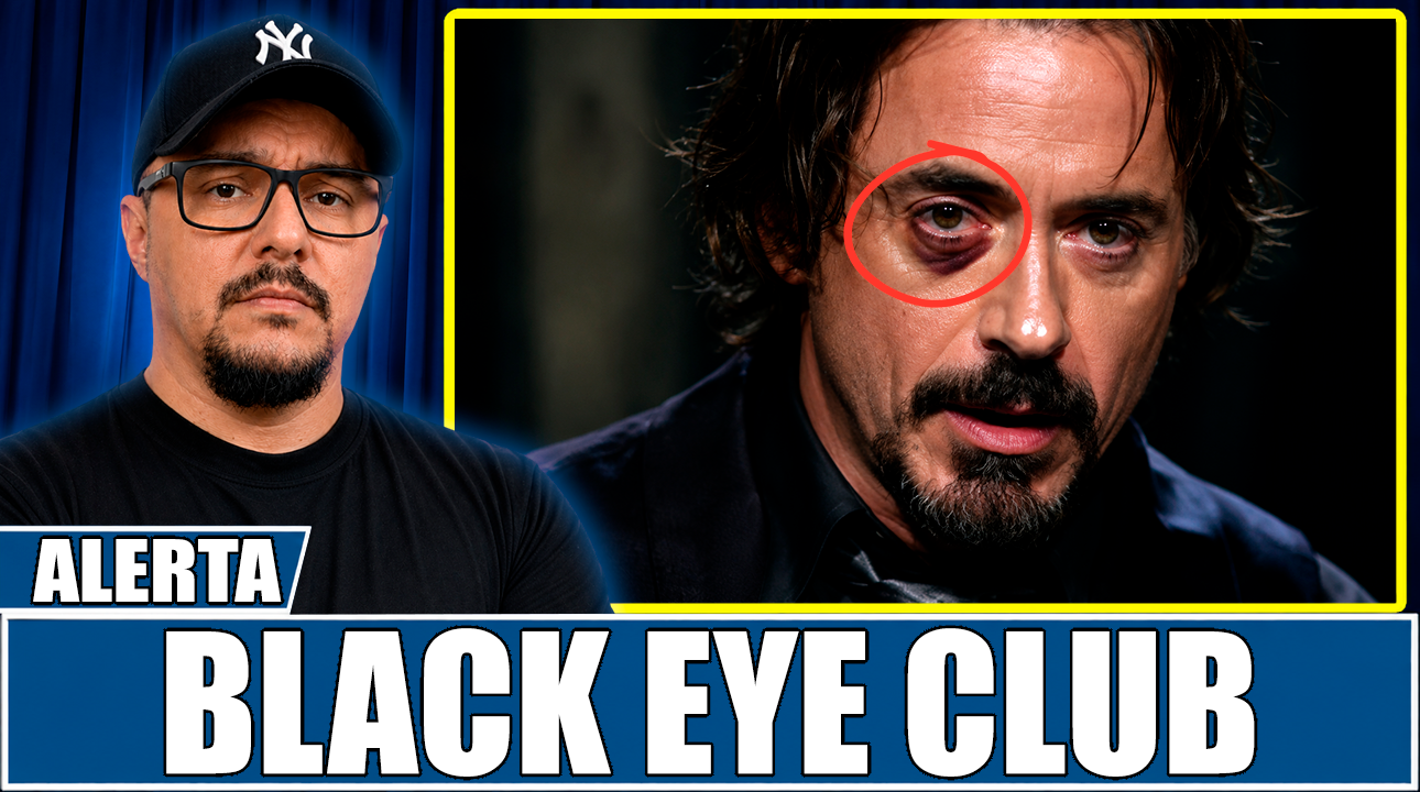 BLACK-EYE-CLUB